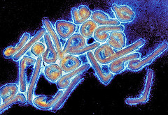 Marburg virus. Credit: Tom Geisbert (CDC)